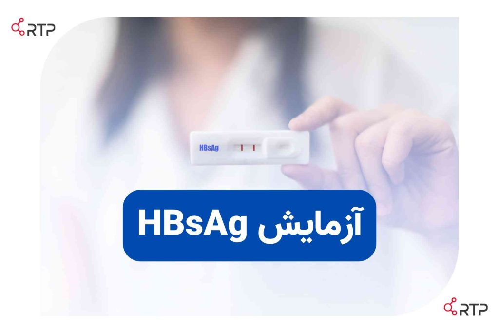 آزمایش HBsَAg