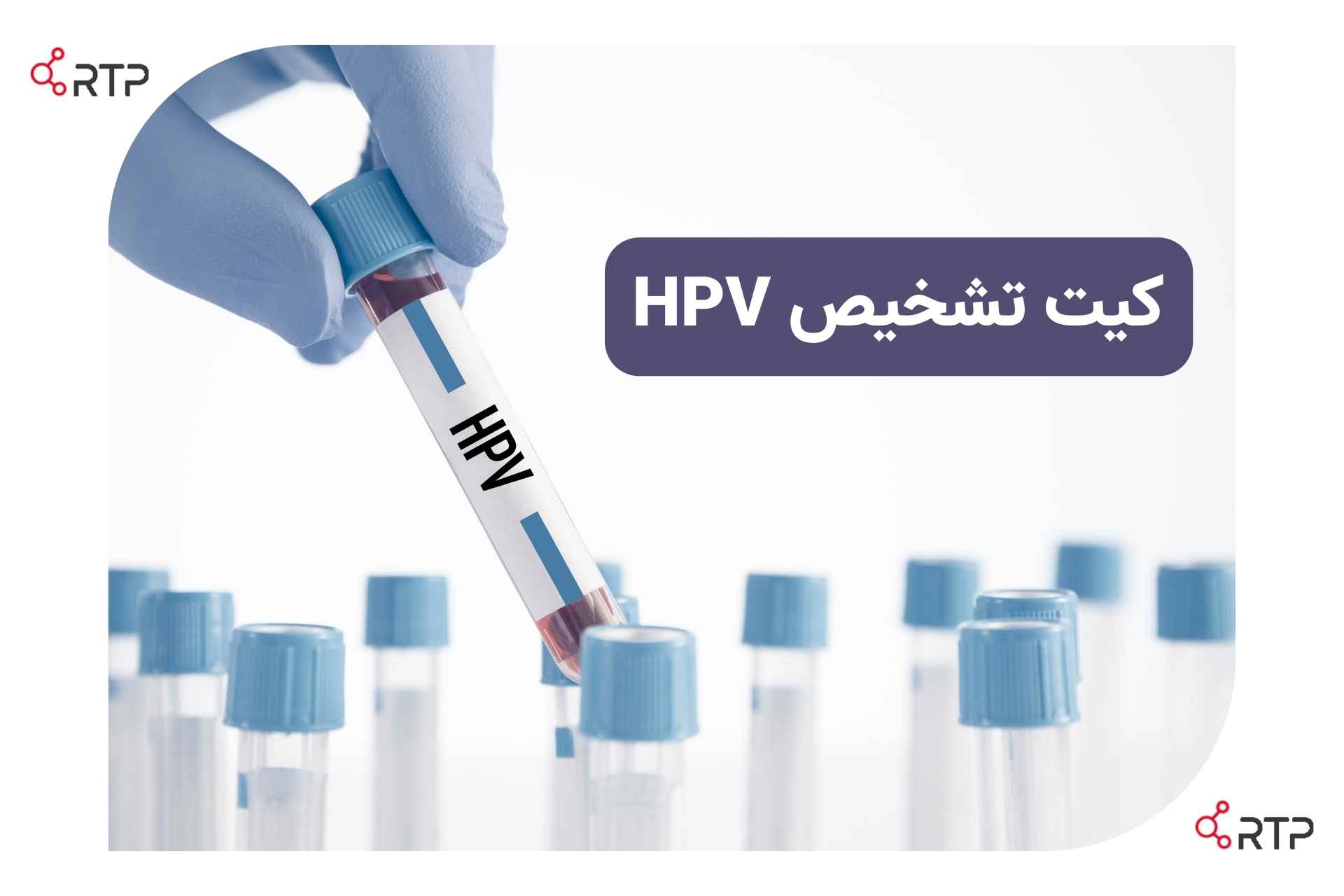کیت تشخیص HPV آبی رنگ