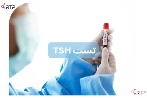 آزمایش TSH- تست TSH
